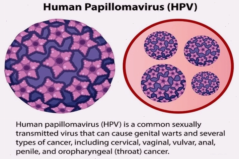 Virus HPV gây nên u nhú sinh dục lành tính dạng mụn nhỏ nhô trên da