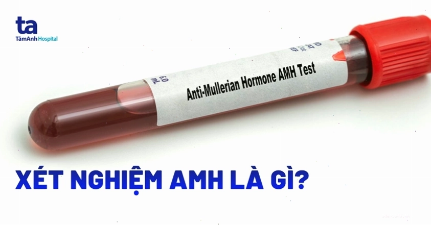 Xét nghiệm AMH giúp đánh giá chính xác dự trữ buồng trứng