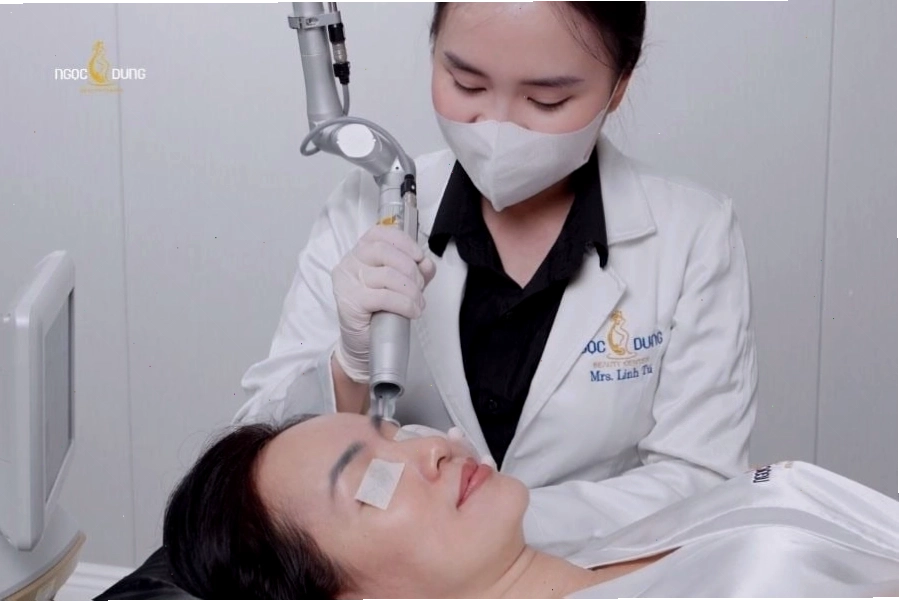 Xóa xăm mí mắt bằng Laser an toàn và hiệu quả
