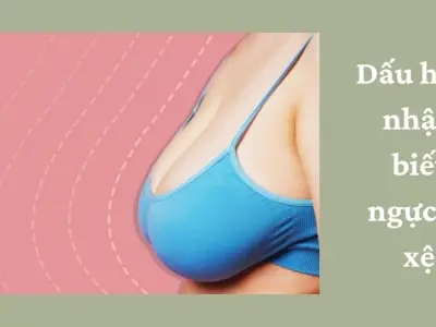 Bí quyết cách làm ngực hết xệ tự nhiên không cần phẫu thuật