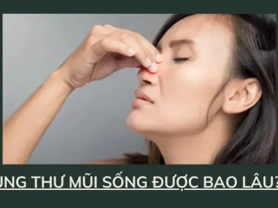 Ung thư mũi sống được bao lâu nếu phát hiện sớm?