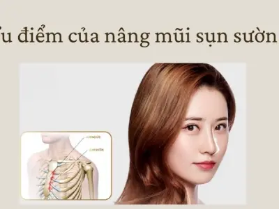 Ưu điểm của nâng mũi sụn sườn giúp mũi đẹp tự nhiên
