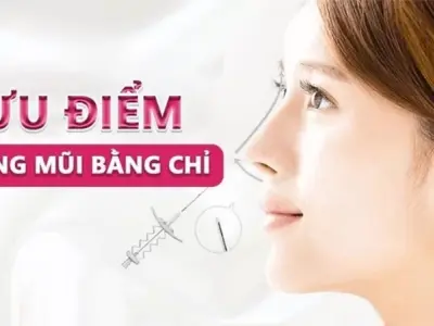 Ưu điểm nâng mũi chỉ giúp bạn giữ dáng mũi lâu dài hơn