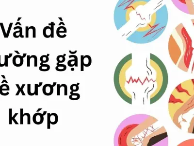 Vấn đề thường gặp về xương khớp khi thay đổi thời tiết