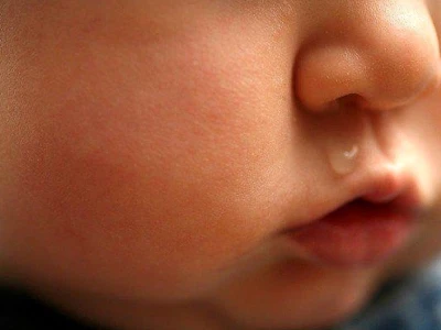 Bé Sổ Mũi Uống Thuốc Gì? Hướng Dẫn Chi Tiết Từ Chuyên Gia