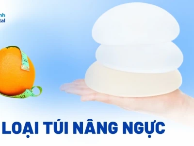 Các loại túi nâng ngực hiện nay: Đặc điểm và lưu ý