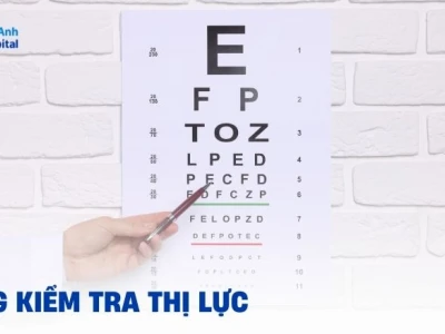 Cách Đọc Bảng Đo Thị Lực Mắt Chuẩn Xác và Ý Nghĩa Các Chỉ Số