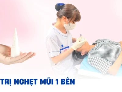 Cách hết nghẹt mũi nhanh chóng và hiệu quả tại nhà