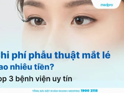 Chỉnh mắt lé kim bao nhiêu tiền và các yếu tố ảnh hưởng