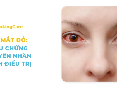 Đau mắt đỏ: Triệu chứng, nguyên nhân và cách phòng ngừa hiệu quả