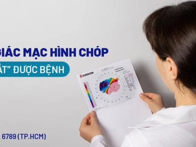 Giác mạc chóp là gì? Nguyên nhân, dấu hiệu và cách điều trị
