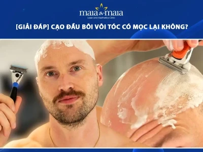 Giải Đáp Thắc Mắc: Cạo Đầu Có Khiến Tóc Không Mọc Lại Không?
