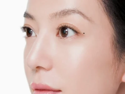Giải mã ý nghĩa nốt ruồi trên mí mắt và dự đoán vận mệnh