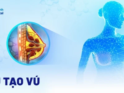Giải phẫu cơ ngực: Cấu tạo chi tiết và tầm quan trọng