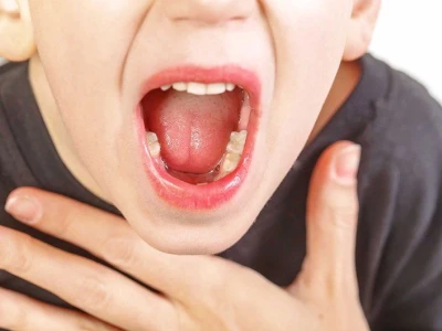Lozenges là gì? Giải đáp thắc mắc về viên ngậm trị viêm họng hiệu quả