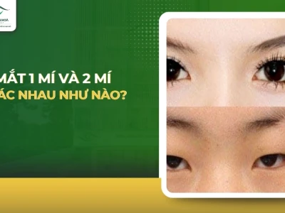 Mắt 2 mí và 1 mí: Phân biệt, đặc điểm và cách khắc phục hiệu quả