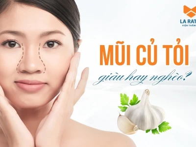 Mũi Củ Tỏi Là Gì? Tướng Số Giàu Sang Hay Khó Khăn