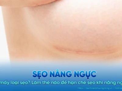 Nâng ngực có để lại sẹo không những yếu tố cần biết