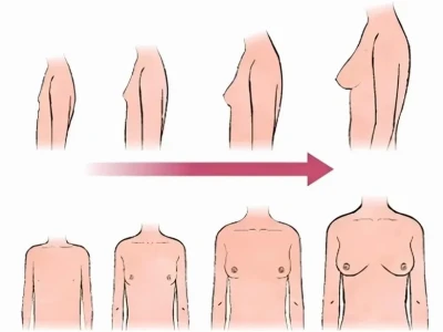 Ngực của con gái: Quá trình phát triển và cách chăm sóc hiệu quả