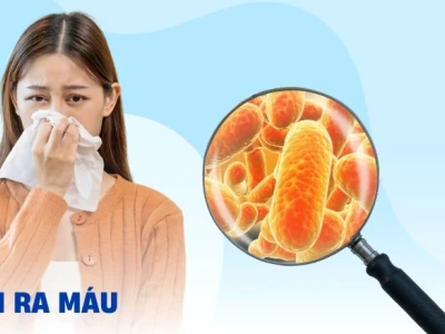Nước Mũi Có Máu: Nguyên Nhân, Dấu Hiệu Nhận Biết và Cách Xử Trí Đúng