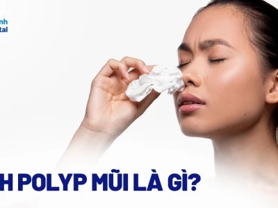 Polyp bên trong lỗ mũi bình thường: Tìm hiểu nguyên nhân và dấu hiệu
