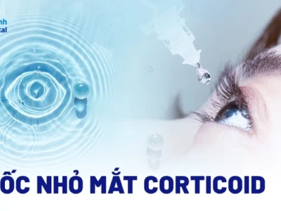 Thuốc Nhỏ Mắt Chứa Corticoid: Công Dụng, Cách Dùng và Lưu Ý Quan Trọng