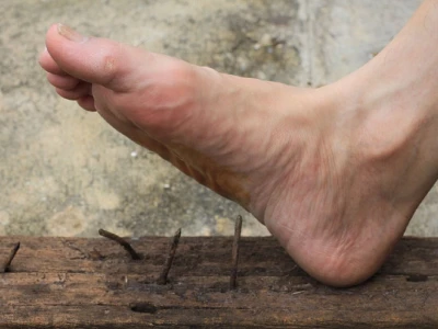 Tiêm uốn ván 1 mũi có được không? Thông tin cần biết