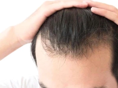 Tóc bò liếm là gì và cách khắc phục hiệu quả tại nhà