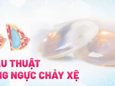 Treo Sa Trễ Ngực: Phương Pháp Nâng Cấp Vẻ Đẹp Vòng 1